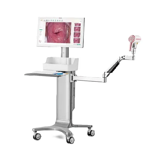 [ED-C12] C12 UHD Colposcopy