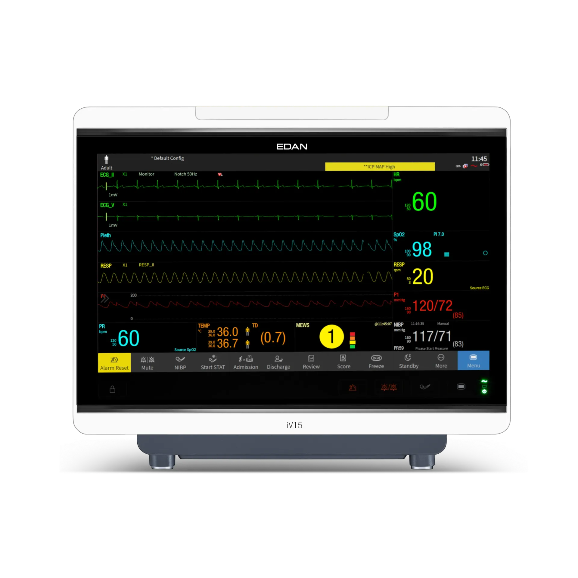 iV-Series Modular Patient Monitor