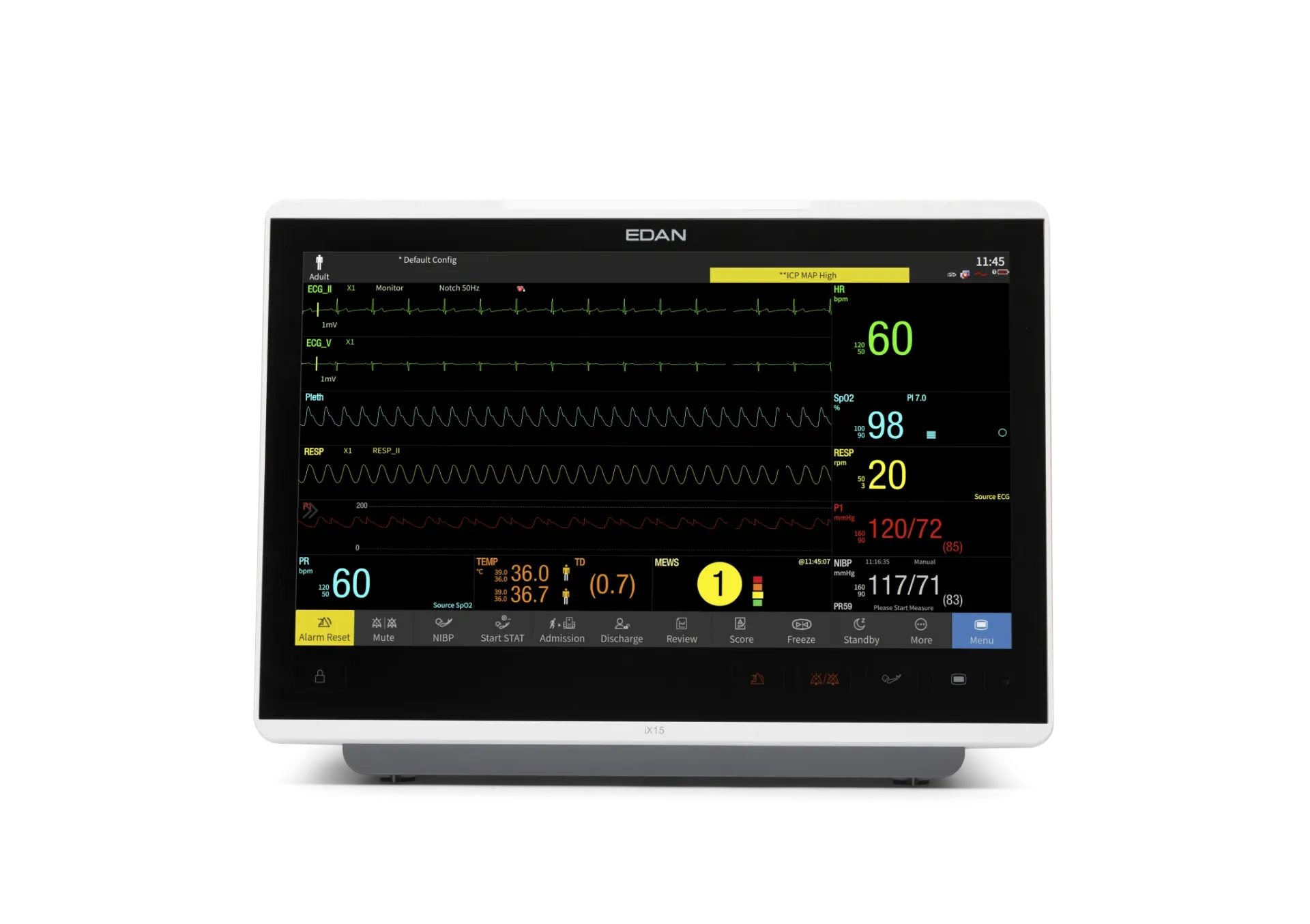 iX-Series Patient Monitor