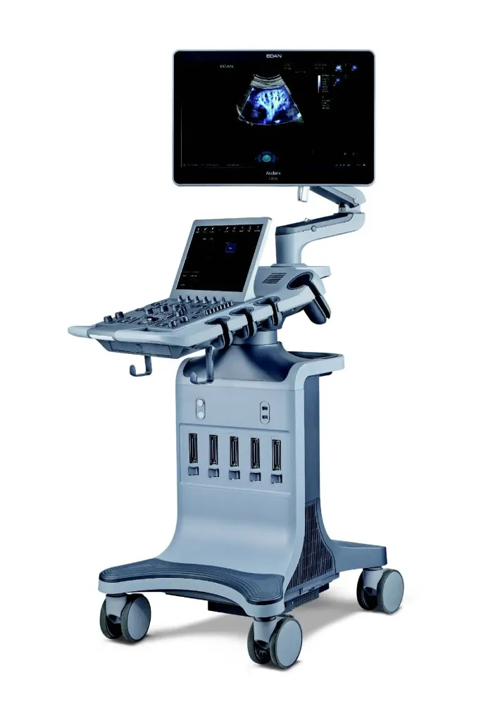 Acclarix LX85 Diagnostic Ultrasound System | Altius Medical